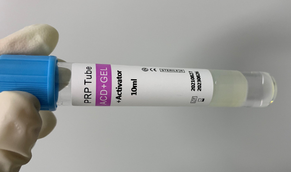 Buy cheap Medical Disposable PRP Products Blood Collection And Separation Tube from wholesalers