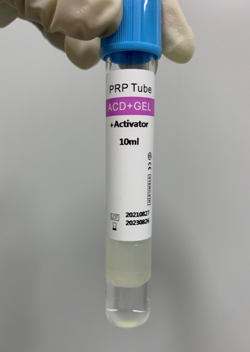 Buy cheap Sterile PRP Tubes 10ml Non Toxic Non Heat Source Blood Collection from wholesalers
