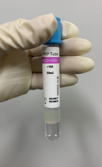 Quality Extraction PRP Products From Platelet Rich Plasma By One Time Separation With Rubber Tube for sale
