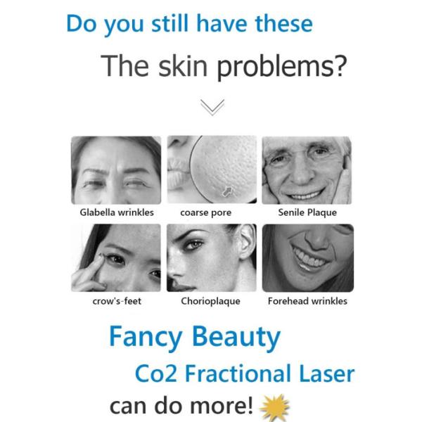 10600NM 40W RF CO2 Fractional Laser Machine Vaginal Tightening High Performance