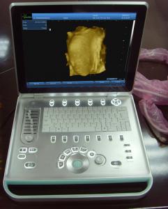 Quality Ultrasound Scanners for sale/PC ultrasound scanner for sale