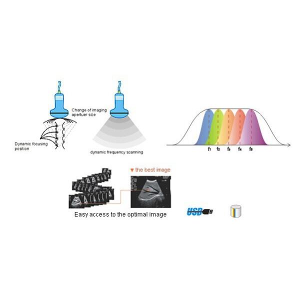Portable ultrasound machine Laptop Ultrasound machine SU-7S with CE