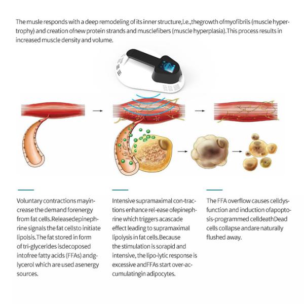 EMS Sculpting Non Invasive Portable Machine With 4 Handles