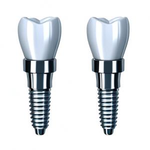 Quality Consistency In Every Crown Our Dental Implant Crown Manufacturing Process for sale