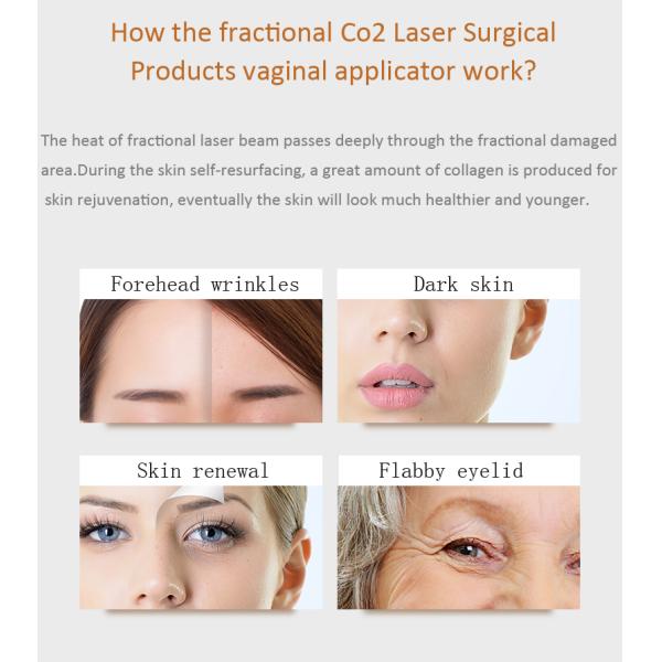 Acne Treatment 10600nm 30W Fractional Co2 Laser Equipment