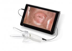 Quality Mini Colposcope for Cervical Examintion Vaginal Camera Connected to TV or PC for sale
