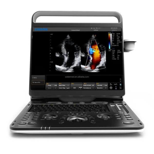 Portable 3D 4D Color Doppler USG&Sonoscape S9