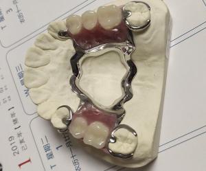 Quality Maxillary Arch Co Cr Alloy Partial Denture Metal Framework for sale