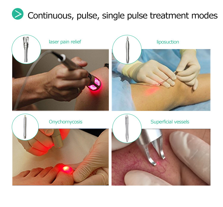 Toenail Fungus Treatment 980nm Diode Laser Medical Laser For Onychomycosis Treatment