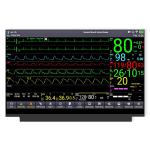 30pin EDP Interface 15.6'' LCD Display TFT LCD Modules For Portable Monitors