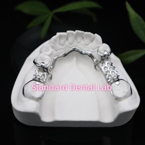 Vitallium 2000 Partial Framework ISO CE And FDA China Dental Lab Metal Framewrok Partial Denture