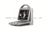 High Accuracy Portable Ophthalmic A B Scan Ultrasound Machine
