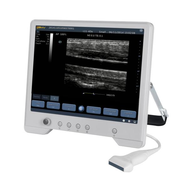 TS20 Digital Diagnostic Ultrasound System for Obstetrics and Gynecology Department