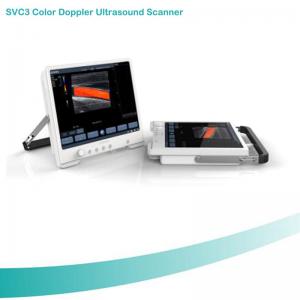 China Smart touch-screen laptop color doppler ultrasound scanning machine pc based Ultrasound scanner on sale