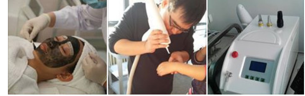 Super Portable Q-Switch ND YAG Solid-state Laser q switch laser supplier