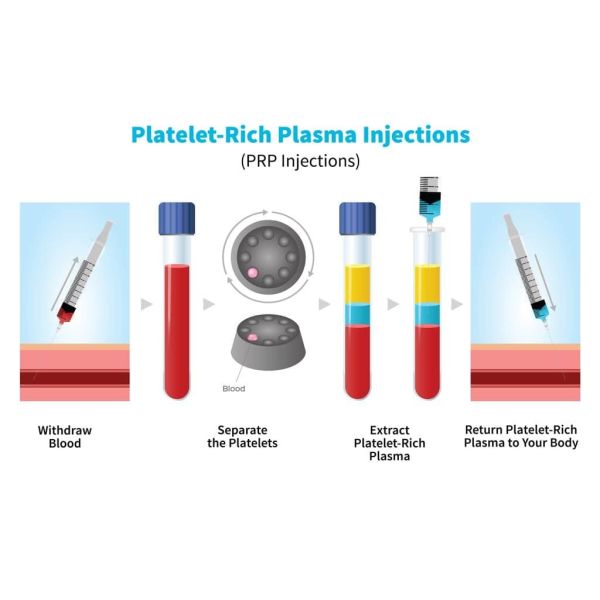 Platelet-Rich Plasma Beauty Centrifuge with Max. RCF 2503 x g and RPM 4000 r/min