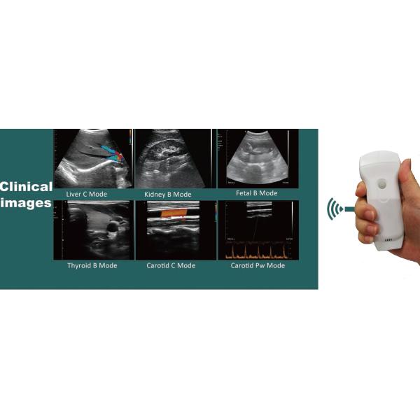 GH G10RL USB Portable Color Doppler Ultrasound Transducer Machine