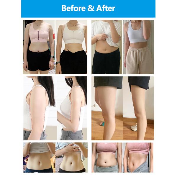 8 Plate 360 Cryolipolysis Cryo Fat Freezing Cryo Plate Weight Loss Machine